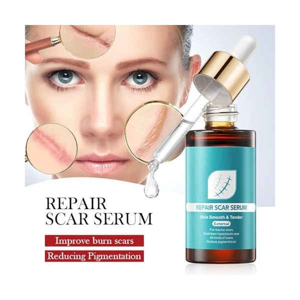 Sérum pour réparer les cicatrices, essence naturelle des cicatrices, sérum délimination des cicatrices pour réparer et lisse