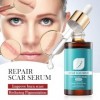 Sérum pour réparer les cicatrices, essence naturelle des cicatrices, sérum délimination des cicatrices pour réparer et lisse