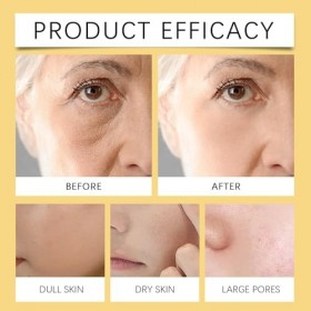 Crème visage anti-rides au venin dabeille, crème raffermissante anti-âge, raffermissement instantané du visage, hydratant an ...