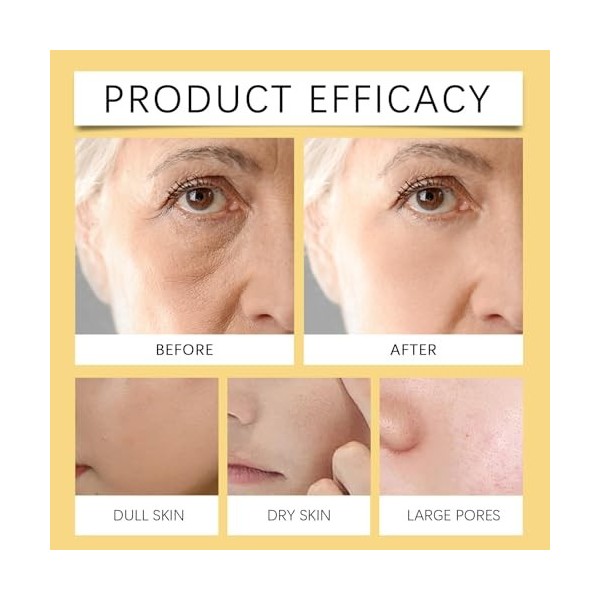 Crème visage anti-rides au venin dabeille, crème raffermissante anti-âge, raffermissement instantané du visage, hydratant an ...