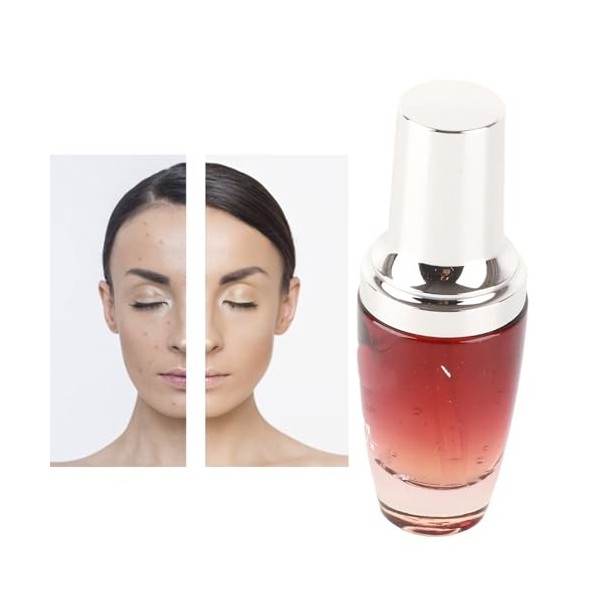 Sérum Anti-Rougeurs, Sérum Apaisant Peaux Sensibles, Sérum Apaisant Visage, Sérum Soin Rougeurs Peaux Sensibles, Hydrate en D