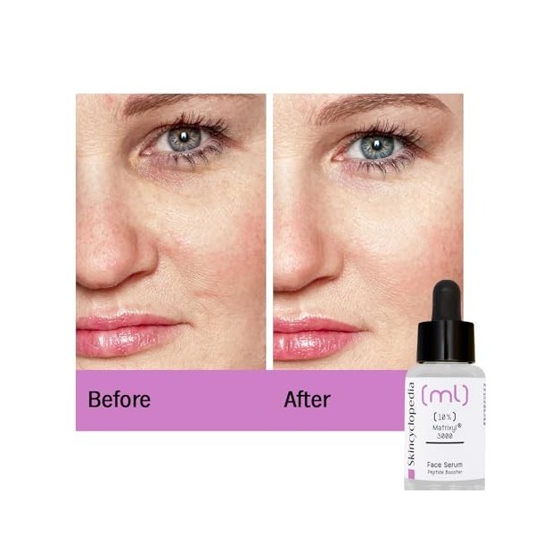 Skincyclopedia Sérum anti-âge Peptide pour le visage avec 10% de matrixyl Soin du visage très efficace contre le vieillisseme