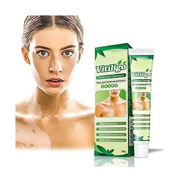 White Tag Treatment Moisturizing Cream, Vitiligo Treatment Repigmentation, Vitiligo Cream for White Spots on Skin, Improve Sk...