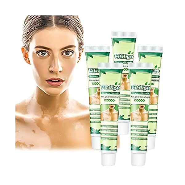 White Tag Treatment Moisturizing Cream, Vitiligo Treatment Repigmentation, Vitiligo Cream for White Spots on Skin, Improve Sk...