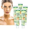 White Tag Treatment Moisturizing Cream, Vitiligo Treatment Repigmentation, Vitiligo Cream for White Spots on Skin, Improve Sk...