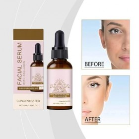 Sérum anti-taches au collagène, Sérum visage 10% niacinamide et de collagène hydrolysé, tonifie la peau et réduit les taches ...