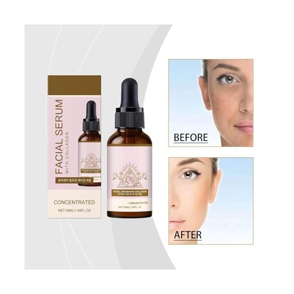 Sérum anti-taches au collagène, Sérum visage 10% niacinamide et de collagène hydrolysé, tonifie la peau et réduit les taches ...