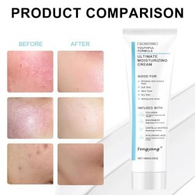 Fengyang® Crème Hydratante, Crème Hydratante A Lacide Hyaluronique, Ridules Et Peaux Sèches, Légère Et Non Grasse, Convient 