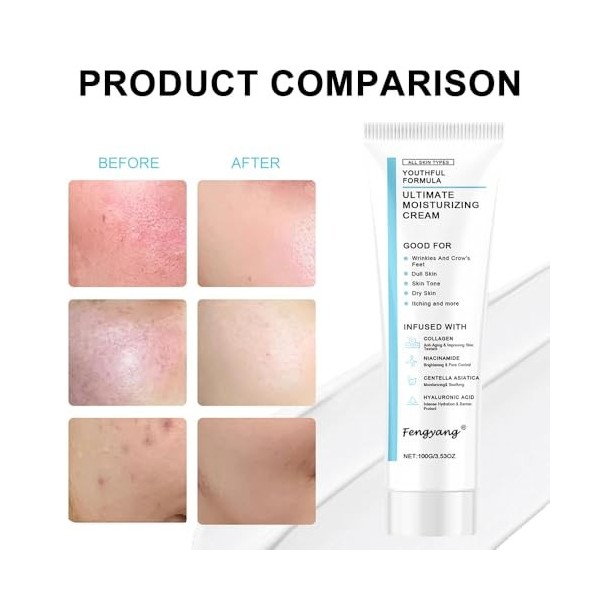 Fengyang® Crème Hydratante, Crème Hydratante A Lacide Hyaluronique, Ridules Et Peaux Sèches, Légère Et Non Grasse, Convient 