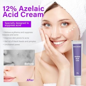 Sérum à Lacide Azélaïque 12%,Cream Azelaic Acid,Crème Dessence pour le Visage à Lacide Azélaïque 12%,Crème de Soin et de R