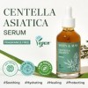 Mary&May Centella Asiatica Sérum Coréen 95% Extrait Pur - Sérum Visage Apaisant pour Peau Irritée - Absorption Rapide Non Col