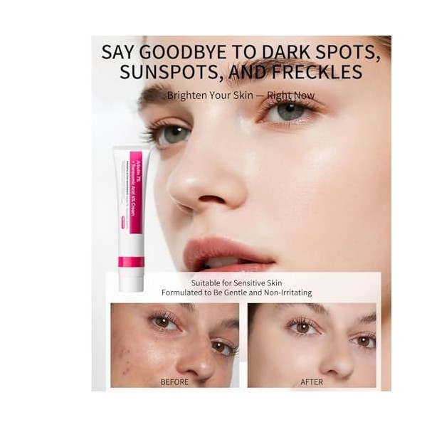 Alpha Arbutin 7% + Tranexamic Acid 4% Cream, Creme Eclaircissante Peau Noir Puissant, Even out Tone, Anti-Pigmentation,Reduce...