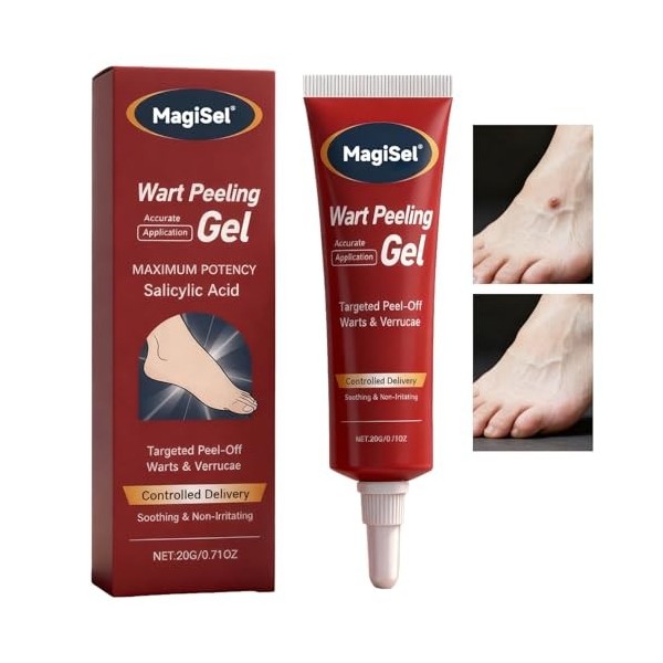 Gel anti-Verrues, Traitement Doux des Verrues Plantaires, Crème anti-verrues, Application Précise, Sans Coulure, Facile à Uti
