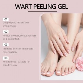 Gel anti-Verrues, Traitement Doux des Verrues Plantaires, Crème anti-verrues, Application Précise, Sans Coulure, Facile à Uti