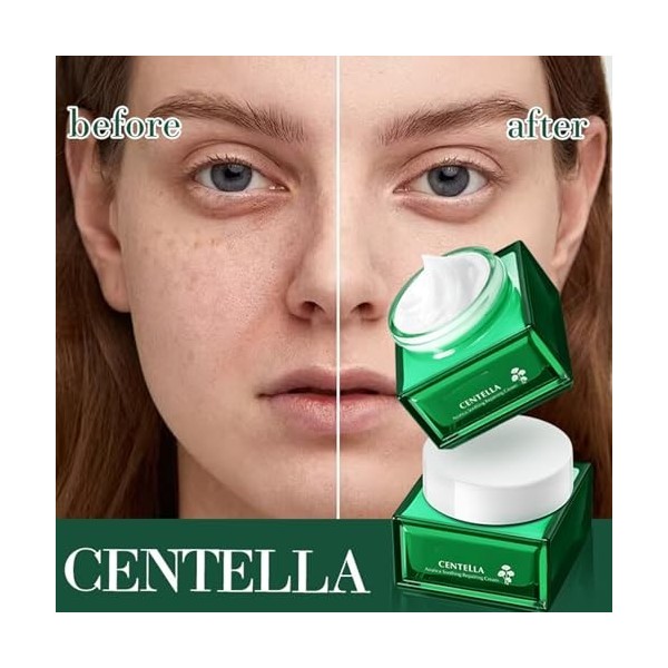 Crème Réparatrice Centella Asiatica 60g, Crème Hydratante Centella, Peaux Sensibles, Teint De La Peau, Apaisant, Répare La Pe
