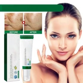 Dark Spot Correcting Glow Sérum Crème pour éliminer les taches sombres du visage, sérums éclaircissants pour un teint uniform...