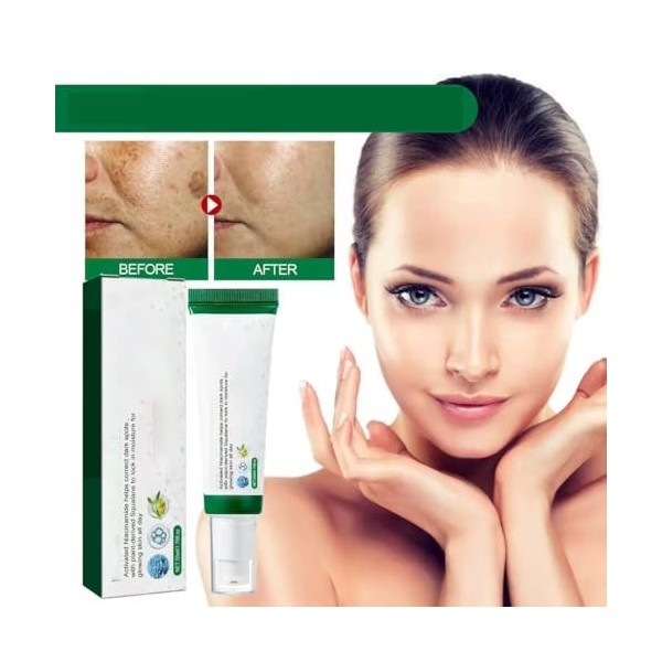 Dark Spot Correcting Glow Sérum Crème pour éliminer les taches sombres du visage, sérums éclaircissants pour un teint uniform...