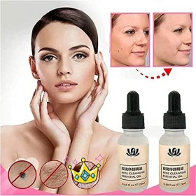 MTDBAOD Organic Tags Solutions Serum,Pure Natural Mole and Skin Tag Remover,Dark Spot Corrector Brightening Serum,Repair Crea
