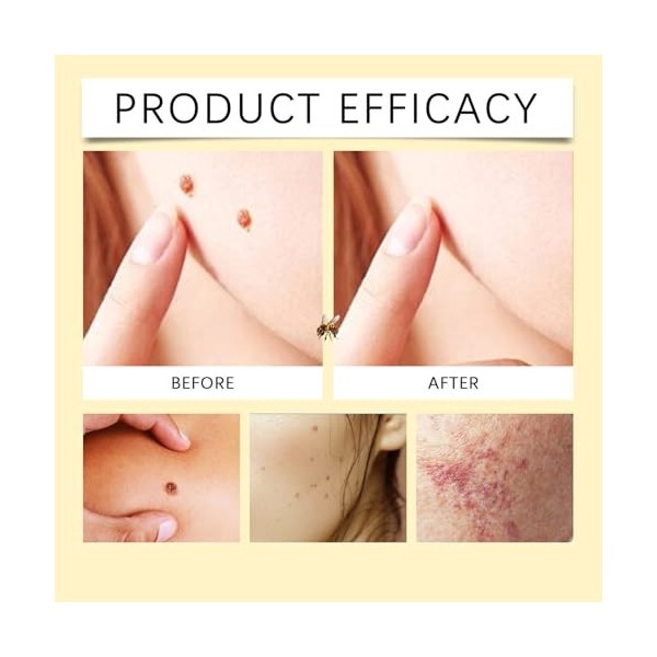 MEITREND Réparation de la peau venimeux