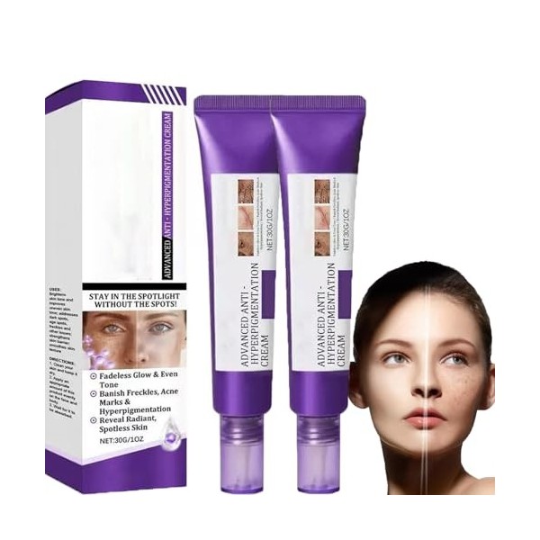 Dark Spot Correcting Glow Sérum pour enlever les taches pigmentaires, traitement hyperpigmentaire, élimine les taches sombres...