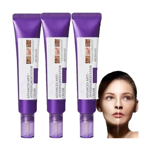 Dark Spot Correcting Glow Sérum pour enlever les taches pigmentaires, traitement hyperpigmentaire, élimine les taches sombres...