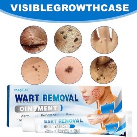 Crème Anti-Verrues, Crème Délimination Instantanée Des Verrues, Wart Removal Cream, Pour Les Types De Peau, 20g