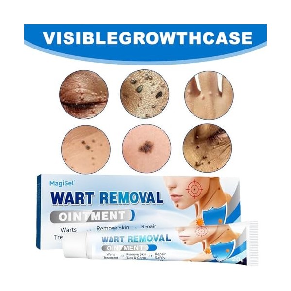 Crème Anti-Verrues, Crème Délimination Instantanée Des Verrues, Wart Removal Cream, Pour Les Types De Peau, 20g