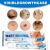 Crème Anti-Verrues, Crème Délimination Instantanée Des Verrues, Wart Removal Cream, Pour Les Types De Peau, 20g