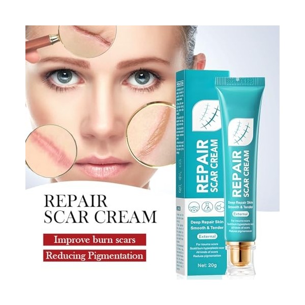 Eazerom Crème Réparatrice pour Cicatrices & Sérun, Kit dAtténuation des Cicatrices pour scars Anciennes et Nouvelles, Crème 
