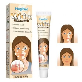 Crème Vitiligo Crème de soin du vitiligo, 20g