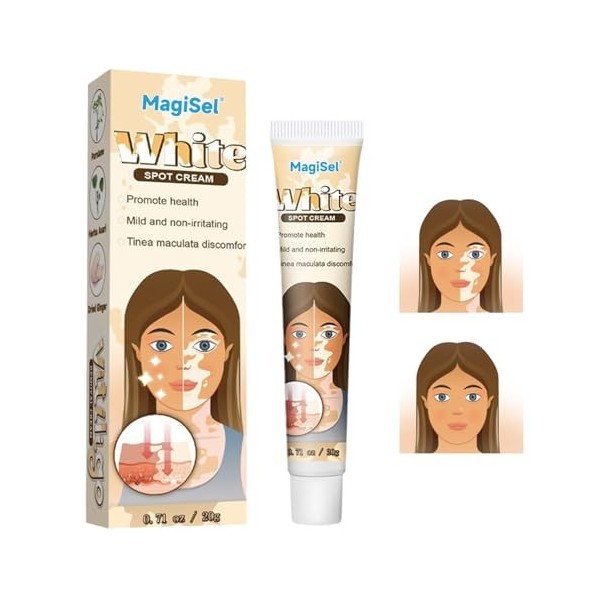 Crème Vitiligo Crème de soin du vitiligo, 20g
