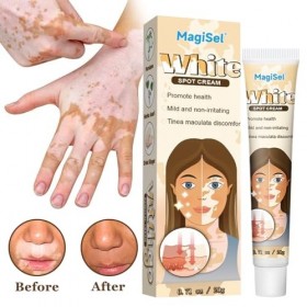 Crème Vitiligo Crème de soin du vitiligo, 20g