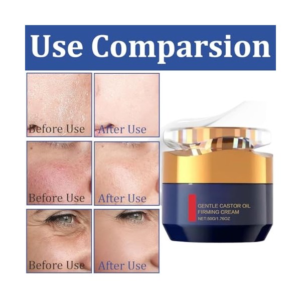 VYIBPDY Crème Antirides Raffermissante Aux Polypeptides, Crème Raffermissante Pour Le Visage, Hydratante, Pour Le Visage De S