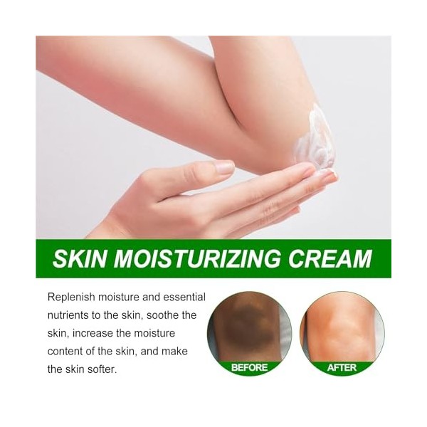 Retinol Skin Whitening Cream, 50 ml, crème éclaircissante pour le corps, coudes et aisselles, éclaircissement de la peau, crè