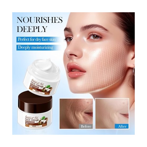 Crème à lhuile de noix de coco 50 g - Crème nourrissante et hydratante polyvalente pour le visage, les mains et le corps - H