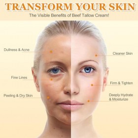 Beef Tallow for Skin, 120g Suif De BœUf Nourri à LHerbe, Tallow and Honey Balm, Hydratant Soins de la Peau au Suif de Bœuf, ...