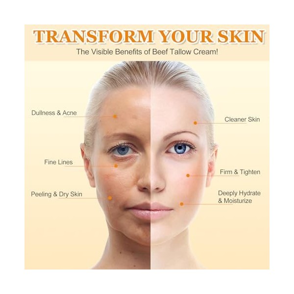 Beef Tallow for Skin, 120g Suif De BœUf Nourri à LHerbe, Tallow and Honey Balm, Hydratant Soins de la Peau au Suif de Bœuf, ...