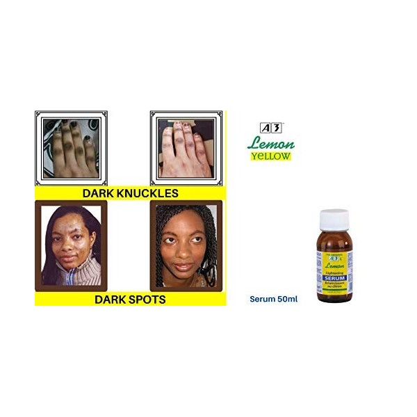 Serum A3 Lemon Lightening Sérum, 50 ml Lot de 2 