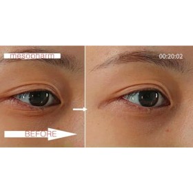 WHITESILK 4 % PDRN & 6 % Sérum de guérison de la peau complexe protéoglycanique Anti-âge, réparation, lifting, hydratant 