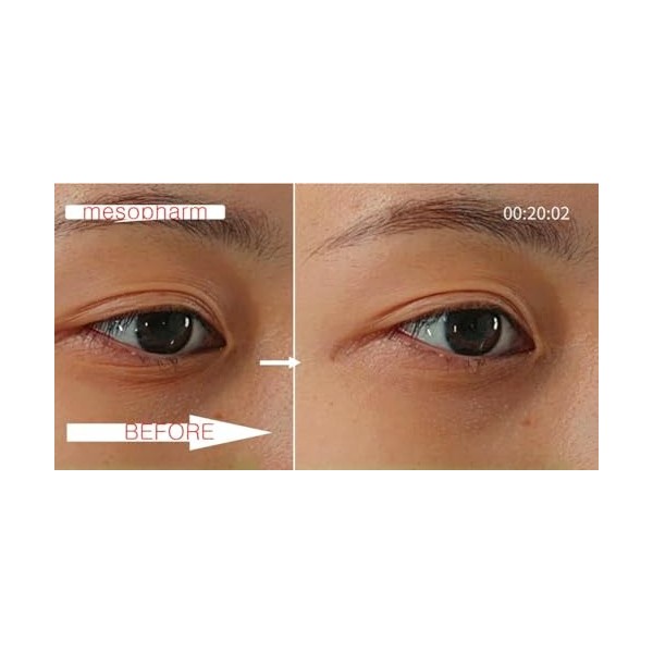 WHITESILK 4 % PDRN & 6 % Sérum de guérison de la peau complexe protéoglycanique Anti-âge, réparation, lifting, hydratant 