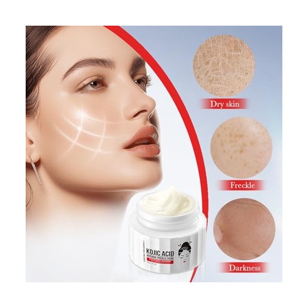 Crème éclaircissante pour le visage à lacide kojique, 50 g, crème hydratante et éclaircissante pour le visage, anti-rides et