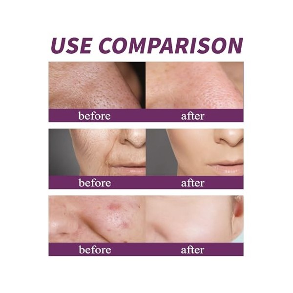 Essence de nicotinamide – Sérum à 20% de niacinamide pour un teint éclatant, une action anti-rides et un resserrement des por...