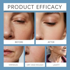 Sérum pour le visage au peptide de cuivre bleu et à lextrait de plante – 30 ml, fluide pour le visage éclaircissant et raffe ...