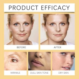 Sérum anti-rides au ginseng – Hydratation profonde et soin anti-rides à lextrait de ginseng, à lacide hyaluronique et à la C...