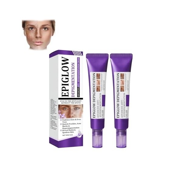 Crème anti-hyperpigmentation avancée Epiglow Melanex de Ceoerty – Crème anti-hyperpigmentation pigmentaire pour le traitement...