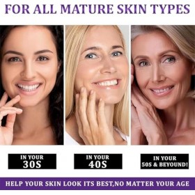 Crème anti-hyperpigmentation avancée Epiglow Melanex de Ceoerty – Crème anti-hyperpigmentation pigmentaire pour le traitement...