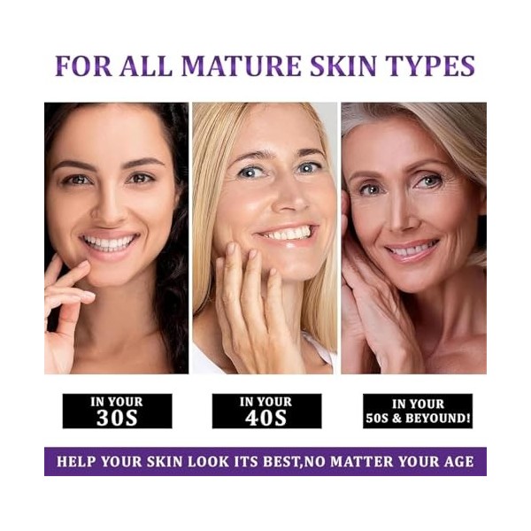 Crème anti-hyperpigmentation avancée Epiglow Melanex de Ceoerty – Crème anti-hyperpigmentation pigmentaire pour le traitement...