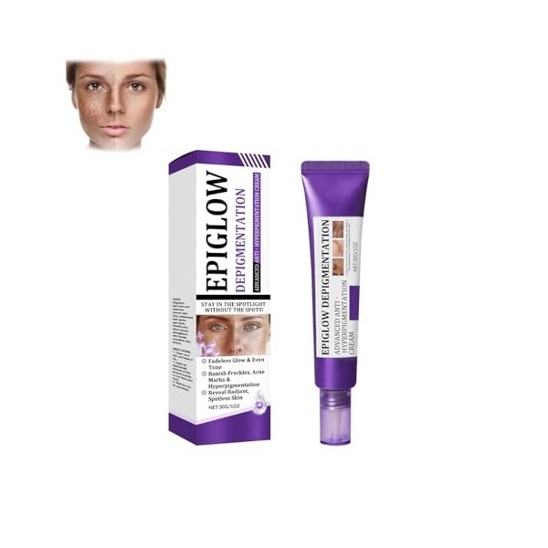Crème anti-hyperpigmentation avancée Epiglow Melanex de Ceoerty – Crème anti-hyperpigmentation pigmentaire pour le traitement...