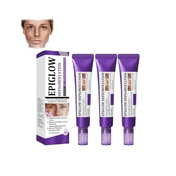 Crème anti-hyperpigmentation avancée Epiglow Melanex de Ceoerty – Crème anti-hyperpigmentation pigmentaire pour le traitement...