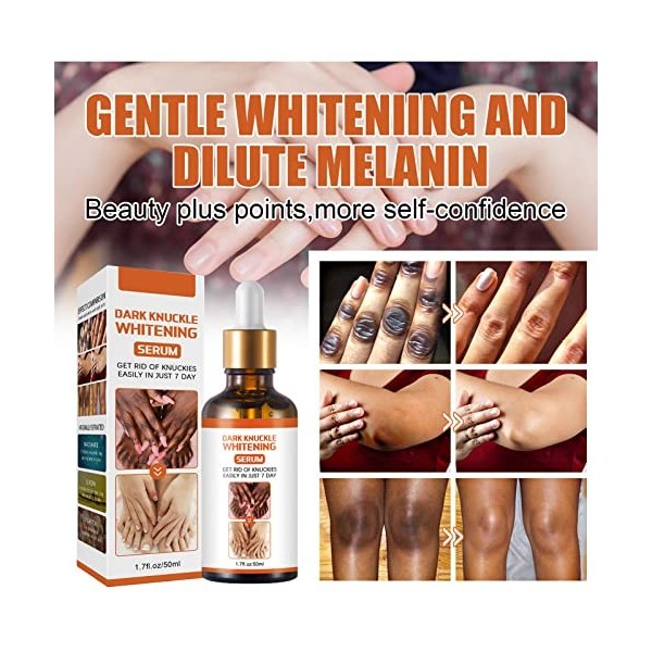 50 G De Sérum éclaircissant Pour La Peau Sérum éclaircissant Pour Améliorer Les Cuticules Hydratant Pour Chevilles Et Coudes,
